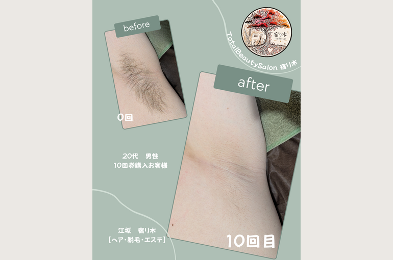 Green Minimalist Before After Fashion Style Instagram Post (1)